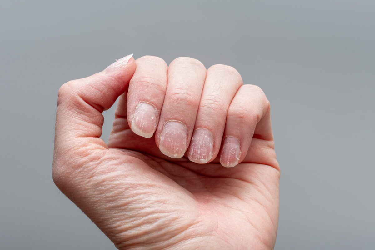 胺基酸缺乏症狀